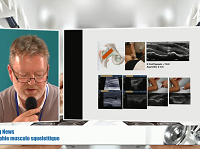 BREAKING NEWS : Echographie musculo-squelettique