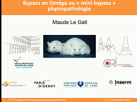Bypass en Oméga ou « mini-bypass » :physiopathologie