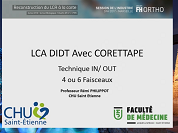 CA DIDT avec CORETTAPE. Technique IN/OUT 4 ou 6 faisceaux CA DIDT avec CORETTAPE. Technique IN/OUT 4 ou 6 faisceaux