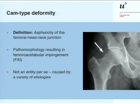 Cam-type deformities and treatment algorithm