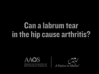 Can a labrum tear in the hip cause arthritis? Can a labrum tear in the hip cause arthritis?