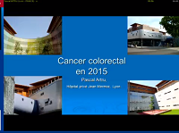 Cancer colorectal
