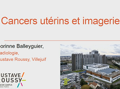 Cancers utérins