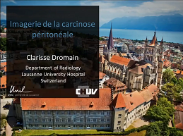 Carcinose péritonéale