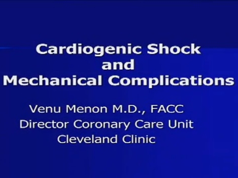 Cardiogenic Shock and Mechanical Complications