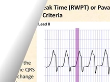 Cardiology pearls n key points