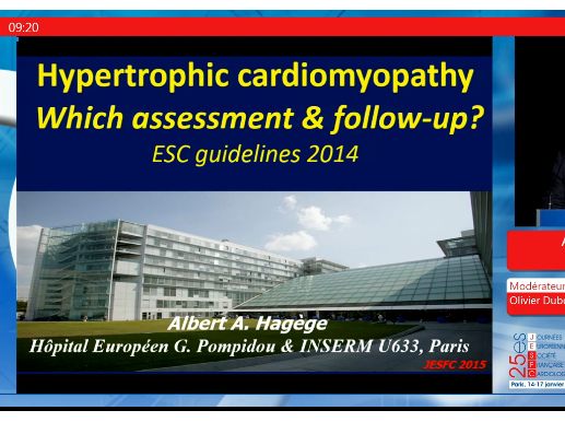 Cardiomyopathie hypertrophique