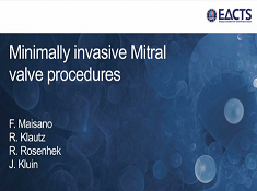Cardiopathie acquise - Méthodes pour la valve mitrale d'invasion minimale Cardiopathie acquise - Méthodes pour la valve mitrale d'invasion minimale