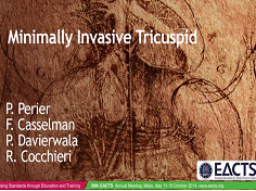 Cardiopathie acquise - Tricuspide d'invasion minimale