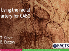 Cardiopathie acquise - Utiliser l'artère radiale pour un greffe en contournant l'artère coronaire (CABG)