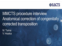 Cardiopathies congénitales - Correction anatomique de la transposition congénitales des artères principales Cardiopathies congénitales - Correction anatomique de la transposition congénitales des artères principales