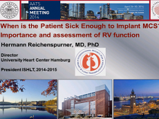 Transplant cardiothoracique et support mécanique circulatoire - Timing d'implantation : Evaluation et prévision du ventricule droit Transplant cardiothoracique et support mécanique circulatoire - Timing d'implantation : Evaluation et prévision du ventricule droit