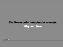 Cardiovascular imaging in women: Why and how