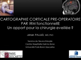 Cartographie cérébrale (1/3) - Imagerie fonctionnelle apport de la chirrugie évéillée Cartographie cérébrale (1/3) - Imagerie fonctionnelle apport de la chirrugie évéillée