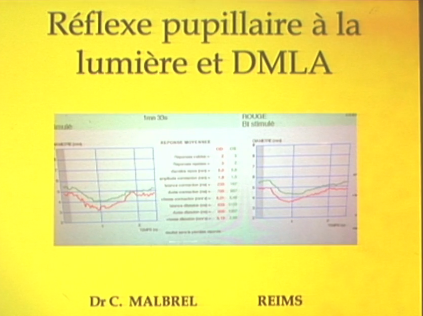 Cas cliniques - Réflexe pupillaire et dmla 2015