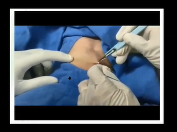 Case 6 : Acute liver failure in school going child - ISPGHAN 2020 conference