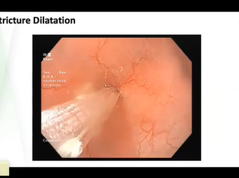 Case snippet -3 (Talk : Probiotics) - ISPGHAN 2020 Conference
