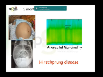 Case snippet 4 - ISPGHAN 2020 Conference