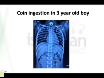 Case snippet 5 - ISPGHAN 2020 conference