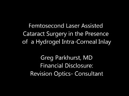Cataracte - Chirurgie de la cataracte assistée par laser femtoseconde avec incrustation d'hydrogel intracornéen Cataracte - Chirurgie de la cataracte assistée par laser femtoseconde avec incrustation d'hydrogel intracornéen