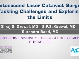 Cataracte - Chirurgie de la cataracte par laser femtoseconde : relever les défis et d'explorer les limites