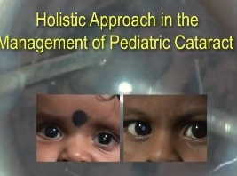 Cataracte - Approche holistique dans la gestion de la cataracte pédiatrique Cataracte - Approche holistique dans la gestion de la cataracte pédiatrique