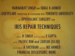 Cataracte - Techniques de réparation de l'iris