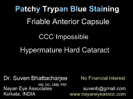 Cataracte - Coloration parcellaire au bleu tryptan / Capsule antérieure friable / Capsulorhexis impossible / Cataracte hypermature avancée