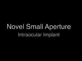 Cataracte - Nouvel implant intraoculaire avec petite incision