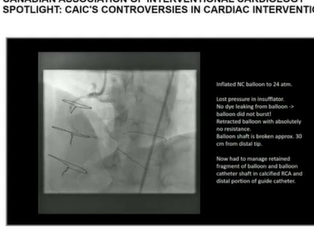 CCC 2019: CANADIAN ASSOCIATION OF INTERVENTIONAL CARDIOLOGY'S CONTROVERSIES IN CARDIAC INTERVENTIONS