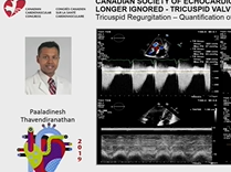 CCC 2019: CSE SPOTLIGHT: NO LONGER IGNORED - TRICUSPID VALVE IMAGING AND INTERVENTION CCC 2019: CSE SPOTLIGHT: NO LONGER IGNORED - TRICUSPID VALVE IMAGING AND INTERVENTION