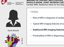 CCC 2019: IMAGING IN CARDIAC AMYLOIDOSIS, WHAT THE CARDIOLOGIST SHOULD KNOW