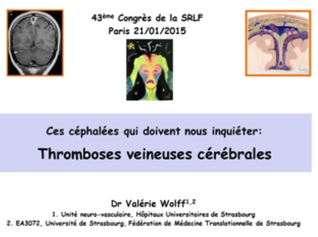Ces céphalées qui doivent nous inquiéter - Thrombophlébite cérébrale - 2015