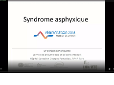 Ces pathologies où il faut aller vite 1