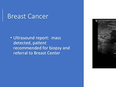 CESM - Dr Juliann Reiland, Breast Surgeon, USA CESM - Dr Juliann Reiland, Breast Surgeon, USA