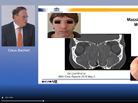 Challenges and strategies for adoption of biologicals