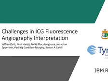 Challenges in the interpretation of colorectal indocyanine green fluorescence angiography Challenges in the interpretation of colorectal indocyanine green fluorescence angiography