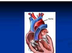 Chest x-ray Superior mediastinal structures Chest x-ray Superior mediastinal structures