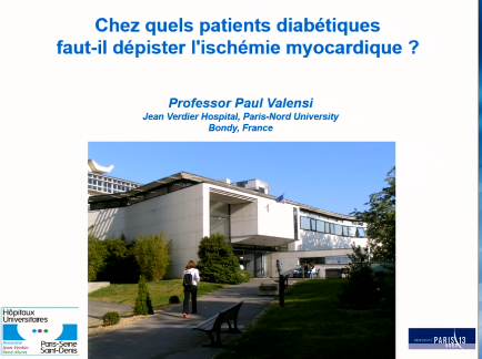 Chez quels patients diabétiques faut-il dépister l'ischémie