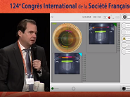 Chirurgie au Laser Femto Seconde Ziemer et Implant RayOne trifocal Rayner