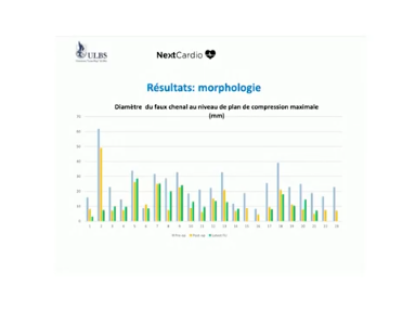 Chirurgie cardiaque et vasculaire à lère des procédures mini-invasives Chirurgie cardiaque et vasculaire à lère des procédures mini-invasives