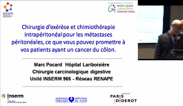 Chirurgie d'exérèse et chimiothérapie intrapéritonéal pour les métastases péritonales, ce que vous pouvez promettre à vos patients ayant un cancer du côlon