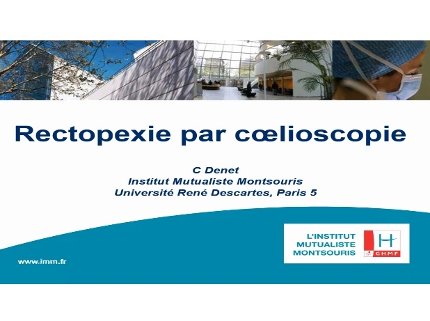 Chirurgie du prolapsus rectal par laparoscopie