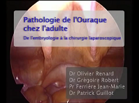 Chirurgie laparoscopique de l'Ouraque - Congrès AFU 2008