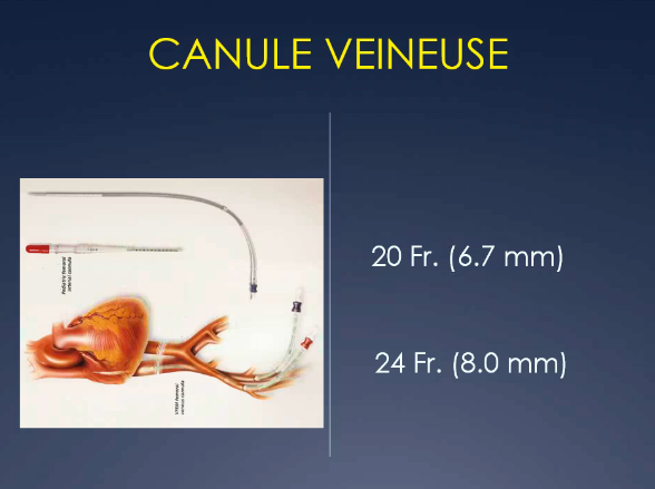 Chirurgie mitrale vidéo assisté: exprience librale lyonnaise