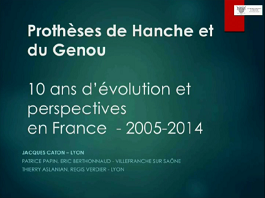 Chirurgie prothétique de la hanche et du genou : évolution et perspective