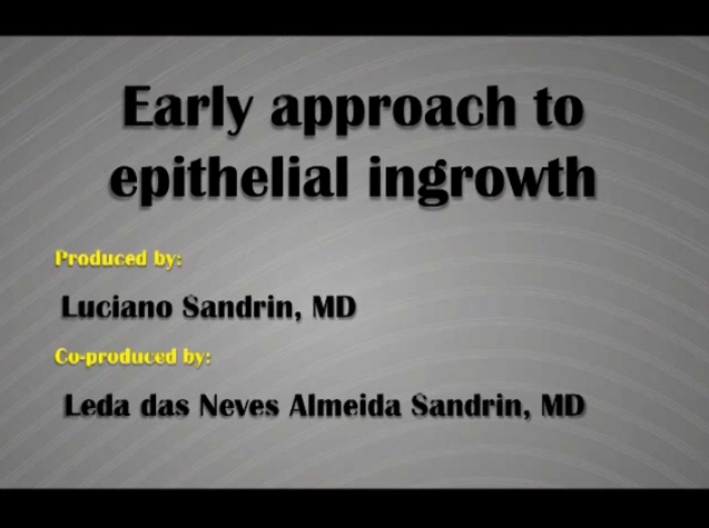Chirurgie réfractive - Approche au début de l'invasion épithéliale après chirurgie LASIK Chirurgie réfractive - Approche au début de l'invasion épithéliale après chirurgie LASIK