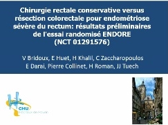 Chirurgie rectale conservatrice versus résection colorectale pour endométriose sévère du rectum : résultats préliminaires de l’essai randomisé ENDORE (NCT 01291576)