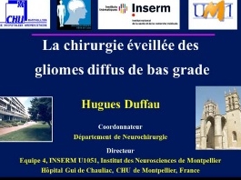 Chirurgie éveillée des gliomes de bas grade : de la pratique clinique à la recherche en neurosciences