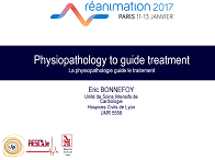 Choc cardiogénique : quelles approches en 2017 ? Quand penser à l'assistance et comment la mettre en place ?